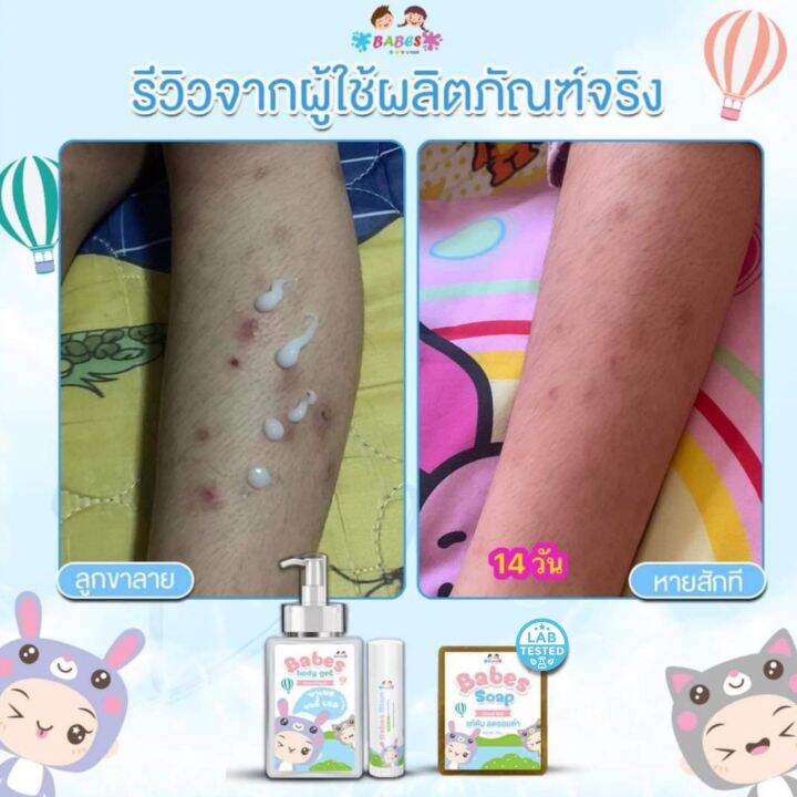 babes-body-gel-บาเบส-บอดี้-เจล-โลชั่นฟื้นฟูผิว-ลดรอยดำ-รอยแดง