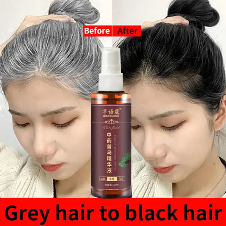 White hair to black hair Hair Growth Essence Natural Black Hair Gray