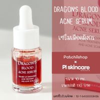 เซรั่มเลือดมังกร Dragons Blood Acne Serum : ลดสิว ลดรอยสิว ลดความมัน | patchiishop