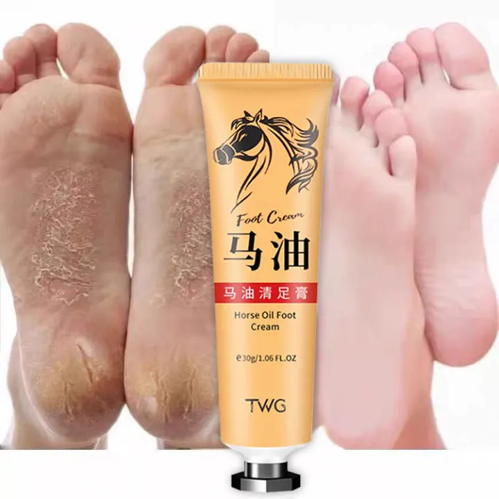 Horse Oil Foot Cream Moisturizing Crack Heel Balm, Kalyo Removal For
