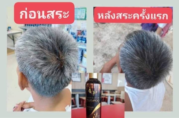 แชมพูปิดผมหงอก-byl-brand-shampoo-organnic-ใช้ดีบอกต่อ