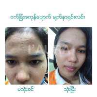 iaurasunscreen