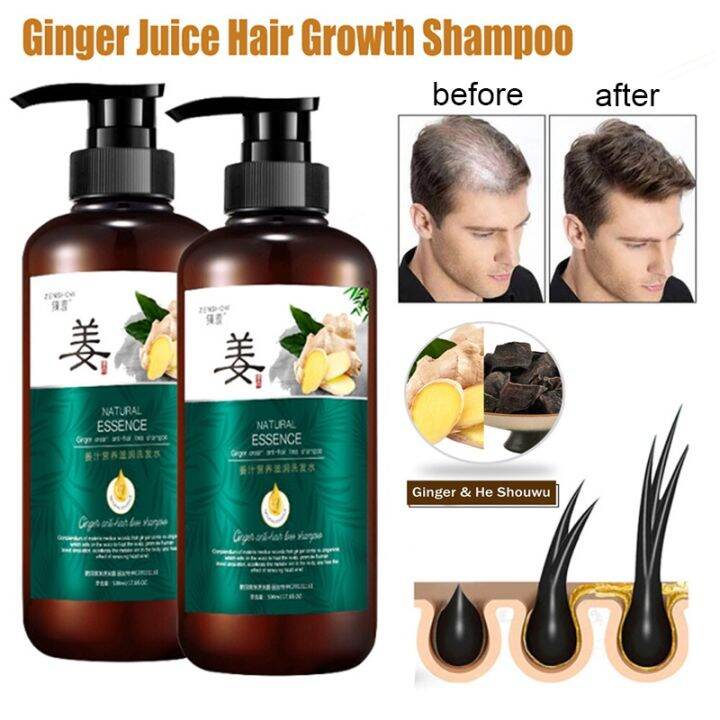 【READY STOCK】Ginger Hair Booster Shampoo Conditioner Treatment Scalp ...