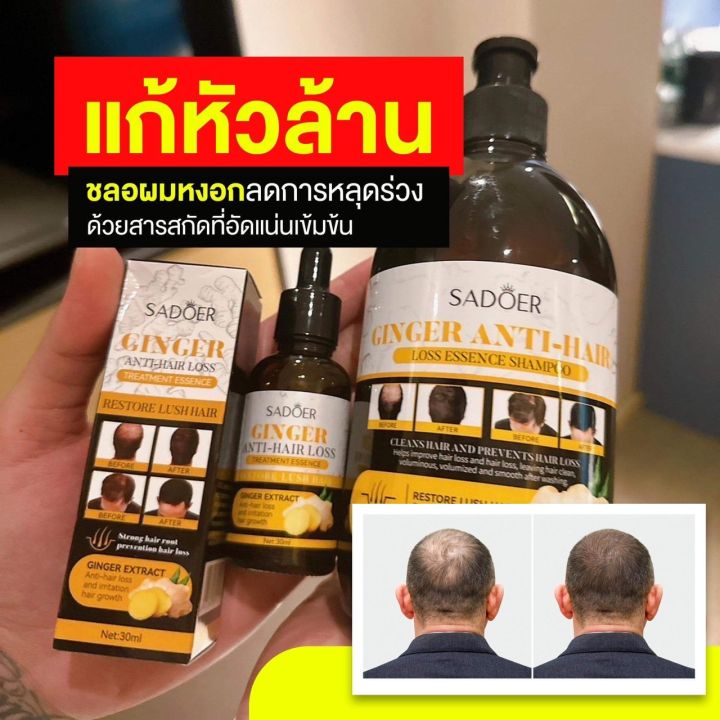 แชมพูขิง-บำรุงเส้นผม-ลดการขาดหลุดร่วง