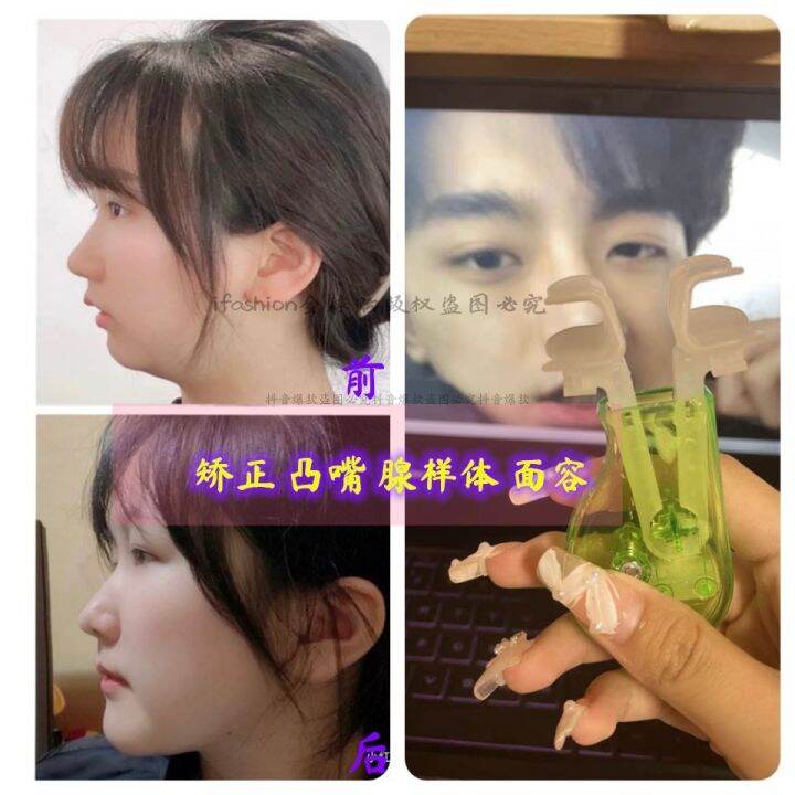 Japanese Mouth Breathing Brace AntiOpening Mouth Closed Mouth Artifact