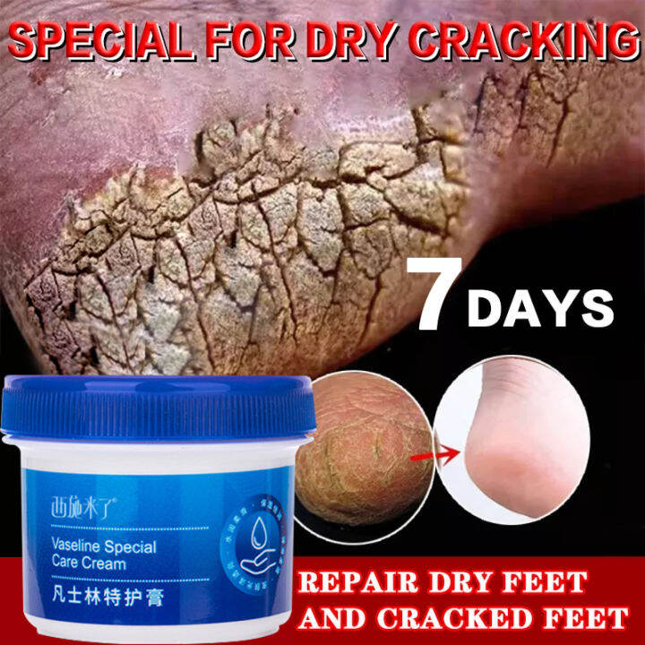 Vaseline Foot Cream Anti Chapped Hand Foot Moisturizing Cream For Dry