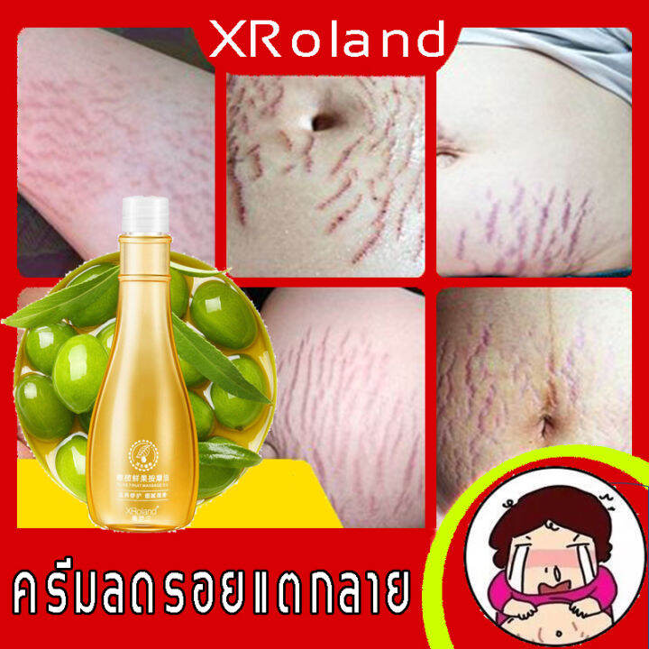 Xroland ครีมกันแตกลาย ช่วยบำรุงและกระชับผิว ซ่อมแซมรอยแตกลาย ของก่อนคลอดและหลังคลอด（ครีมทารอยแตก,ครีมลดลอยแตกลาย,ครีมแก้ขาลาย,แก้แตกลาย, ครีมลดรอยแตกลาย,แก้แตกลาย,ครีมทาขาลาย,ลดผิวแตกลาย,ครีมแก้แตกลาย,ครีมทาท้อง ลาย） | Lazada.Co.Th