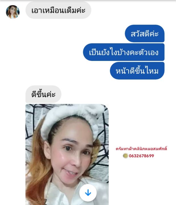 ส่งฟรี-คู่ครีมรักษาฝ้า-หน้าเงาใส-คลินิกหมอสมศักดิ์-นายแพทย์สมศักดิ์-คุณจักร