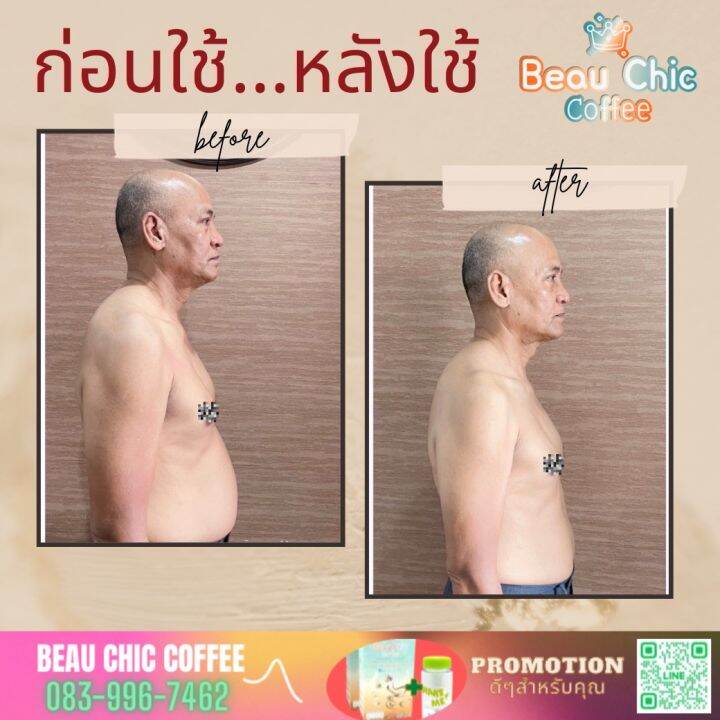 beau-chic-fiber-วันละซอง-ผิวสวยได้ทุกวัน