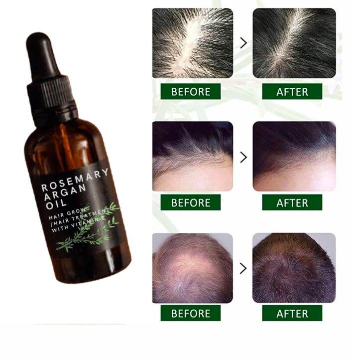 Mikasi Rosemary Argan Oil Hair Grow 15ml For Men And Women Lazada Ph 8831