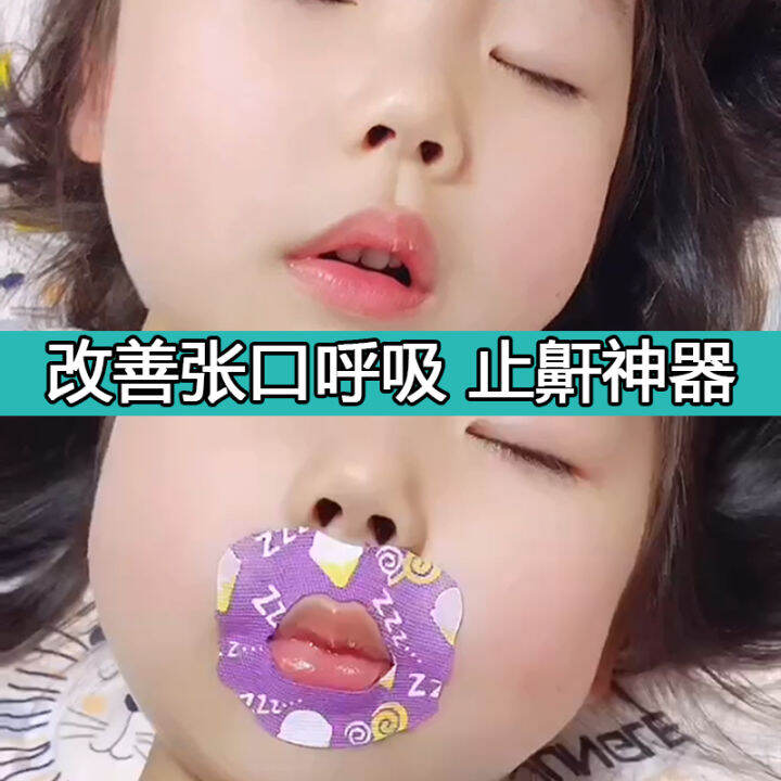 Mouth Sealing Stickers AntiOpening Mouth Sleeping Mouth and Breathing