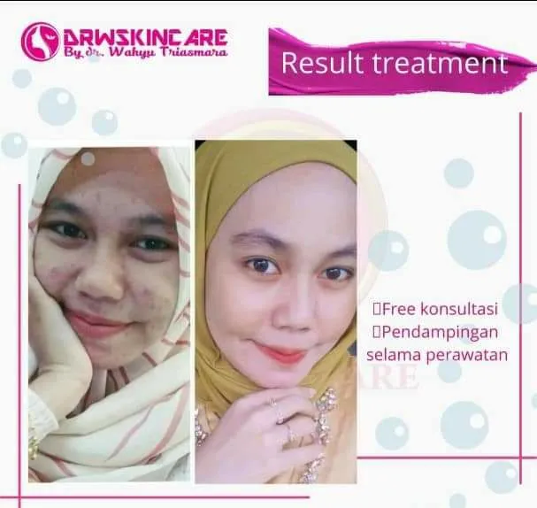 Drw Skincare Dokter Wahyu Triasmara