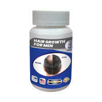 Hair Growth For Men