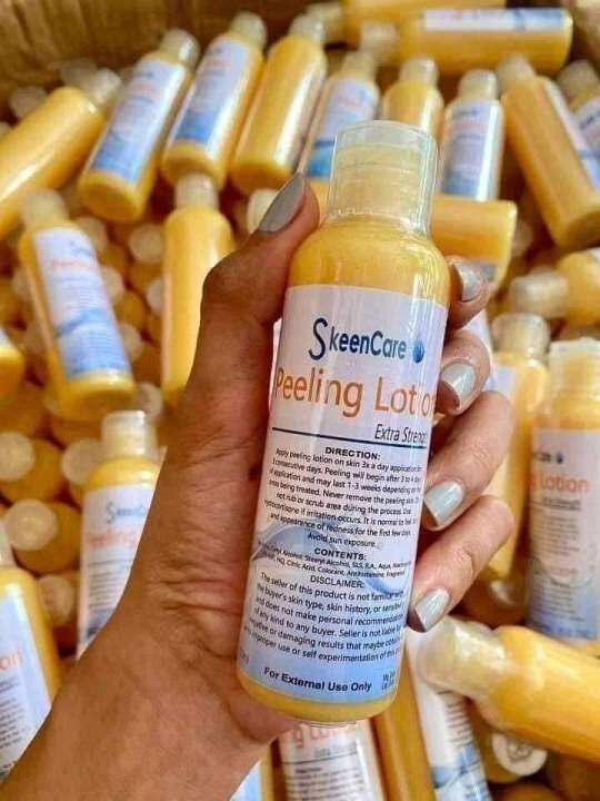 Skeencare Yellow Peeling Lotion Lazada PH