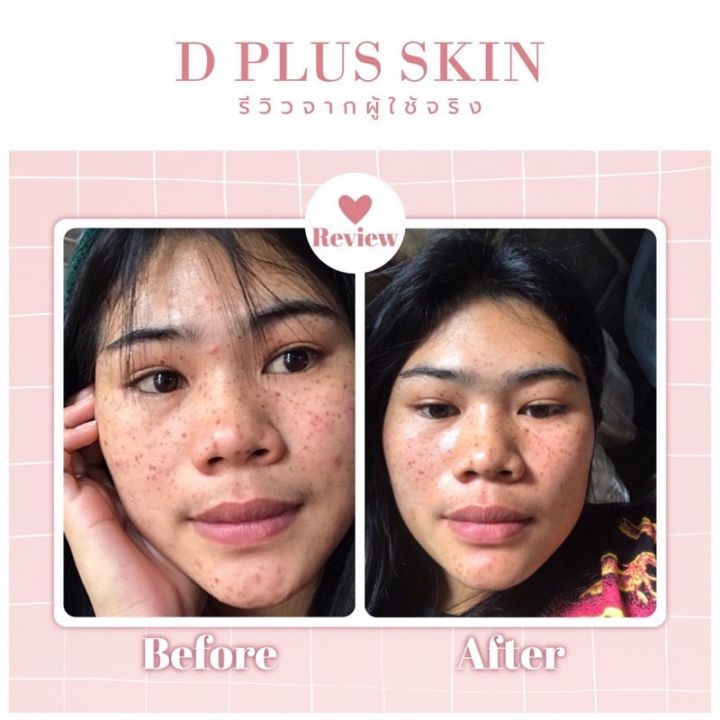 ของแท้-พร้อมส่ง-แกร๊ปคลอลาเจน-d-plus-skin-grab-collagen-คอลลาเจนผิวใส-grab-collagen-แก๊ปคอลลาเจน