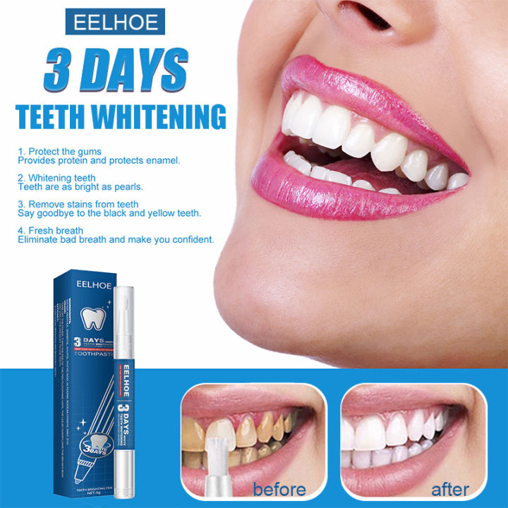 EELHOE Whitening Teeth Gel Pen days whitening toothpaste teeth whitening  stain removal hismile toothpaste colour corrector serum yellow teeth  cavities plaque elimination fresh breath tooth bleach serum oral care  remove teeth