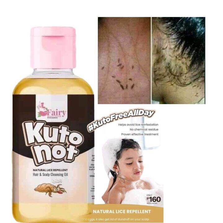 Kuto Not Kuto Removal Natural Lice Treatment Scalp Cleansing Oil