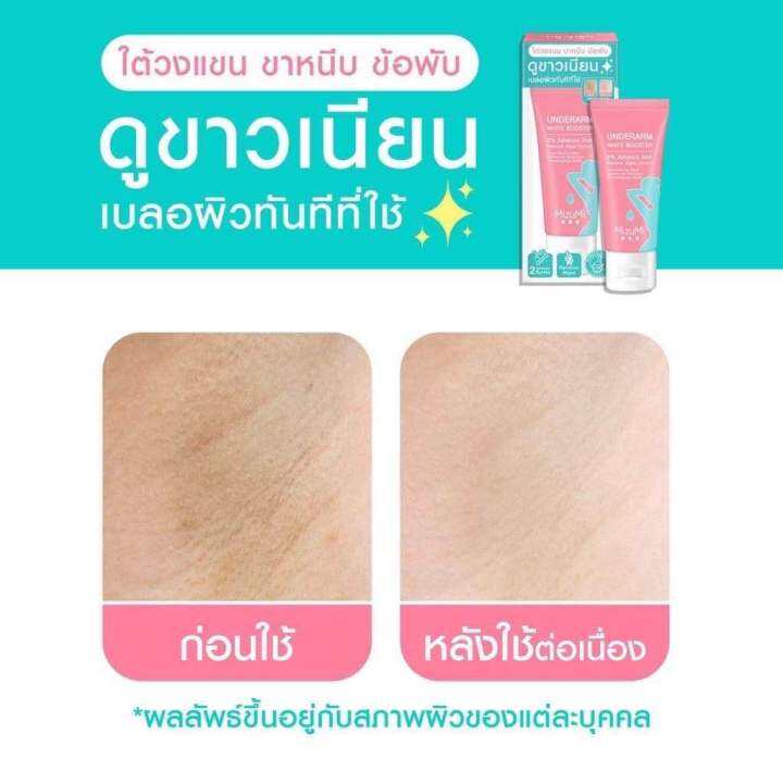 mizumi-underarm-white-booster-30g-ครีมทารักแร้-ขาหนีบ-ง่าม-ข้อพับ-ผิวดูกระจ่างใส-เรียบเนียน-พร้อมเบลอผิวทันที