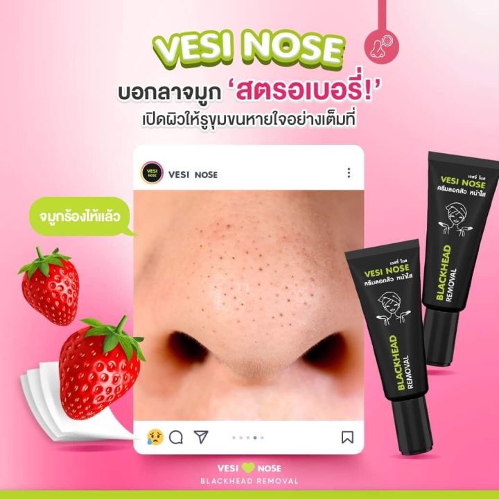 vesi-nose-ครีมลอกสิวเวสซีโนส-แค่แปะผิวก็เนียน-สิวเสี้ยน-สิวหัวดำ-สิวอุดตัน