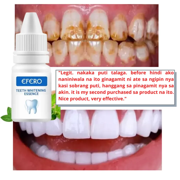 EFERO Teeth Whitening Essence Gel Effectively removes dental stains and plaque Dental Cleaning