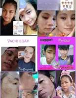 Vachi လိမ္တယ္ ​??

ေျပာေတာ့၀က္ၿခံေတေပ်ာက္မယ္တဲ့ 

အခု၀က္ၿခံေတေပ်ာက္တဲ့အျပင္ 

အဆီျပန္တာေတ အမဲစက္ေတ တင္းတိပ္ေတ အဆီဘု ေတ

 အားလုံးေျပာက္ကုန္တယ္ ?မ်က္ႏွာေလးတင္းရင္းၿပီး Glow ေနေရာ ဘဲ ?

လိမ္တယ္ Vachi