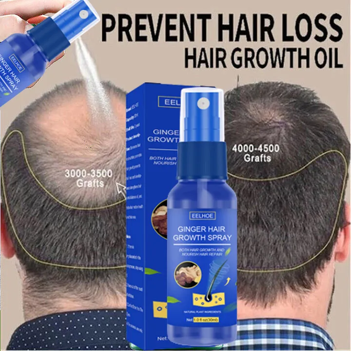 EELHOE Hair Growth Spray Promotes Hair Growth Hair Growth Spray Ginger Extract Prevent Baldness