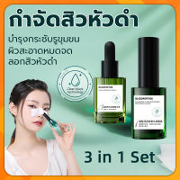 AOPY สูตรอ่อนโยน กำจัดสิวหัวดำ 3 in 1 Set ลบสิวหัวดำและสิว ขจัดผิวที่ตายแล้ว บำรุงกระชับรูขุมขน ผิวกระจ่างใส สิวอุดตัน ลอกได้ทั้งหน้า สูตรใหม่ ครีมลอกสิวเสี้ยน ลอกสิวหัวดำ สำหรับคนเป็นสิว และผิวแพ้ง่าย ( ที่ลอกสิวเสี้ยน ลอกสิวเสี้ยน มาร์คหน้าสิวเสี้ยน)