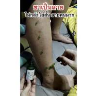 Bioscarไบโอสการ์ ลบแผลเป็น ตุ่ม รอยสิว แผลเป็น น้ำเหลืองไม่ดี ผิวแพ้ง่ายใช้ได้ !!  ปรับผิวขาว เรียบเนียน ลบรอย เข่าดำ ศอกดำ คอดำ ต้องใช้ เซรั่มเข้มข้น