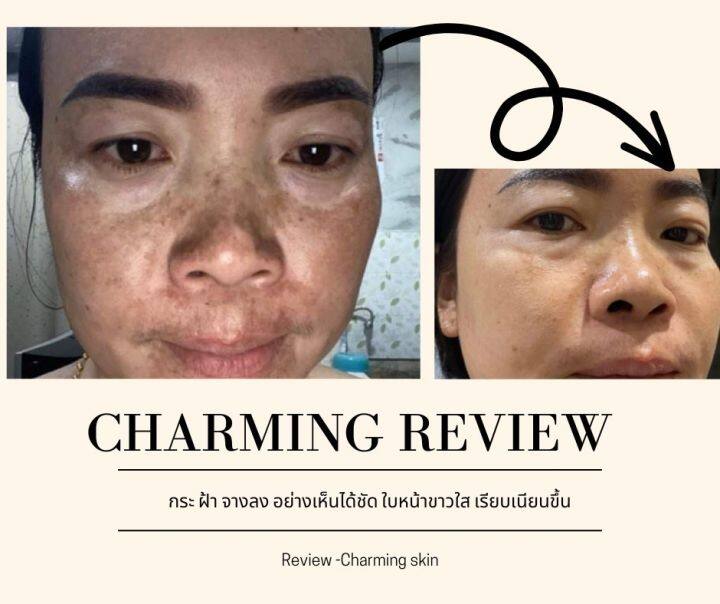 charming-night-cream-ผิวใสได้ไม่พึ่งหมอ-หนักแค่ไหนก็หายได้-ทุกปัญหาผิวหน้า-สิว-ฝ้า-กระ-รอยดำ-รอยแดง-รูขุมขนกว้าง-หลุมสิว-ผิวแห้ง-อาหารผิวสูตรเข้มข้น-มีเลขที่จดแจ้ง-ปลอดภัย-ใช้ง่าย-ใช้ได้แม้-ผิวแพ้ง่าย