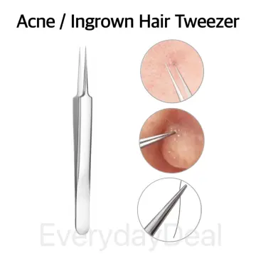 MR.GREEN Ingrown Hair Tweezers Needle Nose Pointed Tips Tweezers For  Eyebrows Splinters Blackhead Removal Acne Clip Extractor (Long)