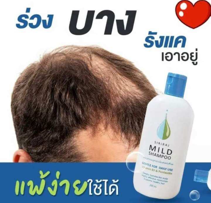 พร้อมส่งทุกวัน-มายแชมพูศิริราช-ยาสระผมส่งตรง-รพ-ศิริราช-ลดปัญหาผมหลุดร่วง-ลดรังแค-บำรุงรากผม-ฟื้นฟูผมให้แข็งแรง