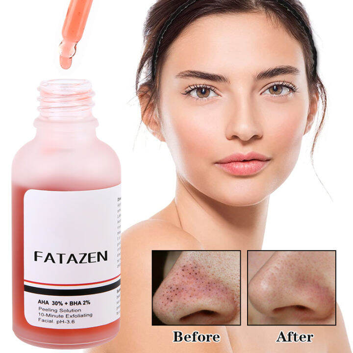 Peeling Solution AHA 30 + BHA 2 Fruit acids Acne Removing Serum