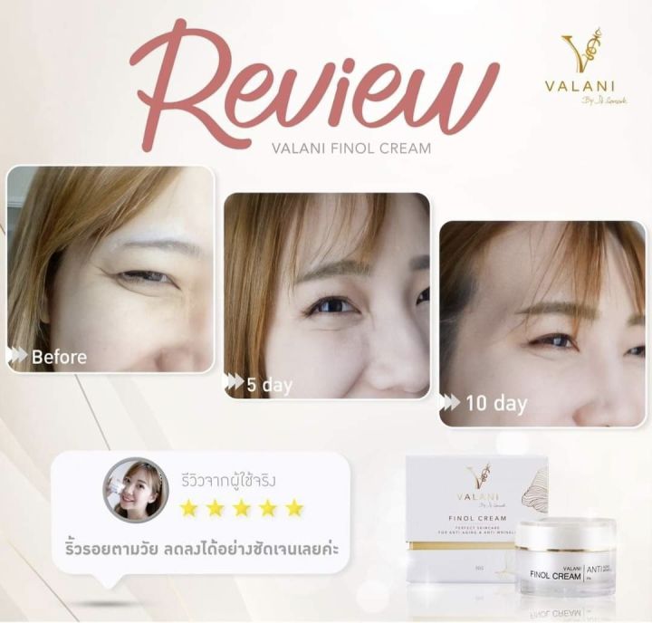 valani-finol-cream-anti-aging-anti-wrinkle-ครีมย้อนวัยผิว-อ่อนเยาว์-ด้วยสารสกัดพรีเมี่ยม5ตัวจากฝรั่งเศส