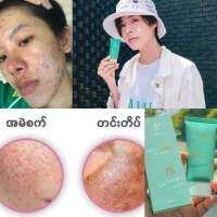 IAURASUNSCREEN