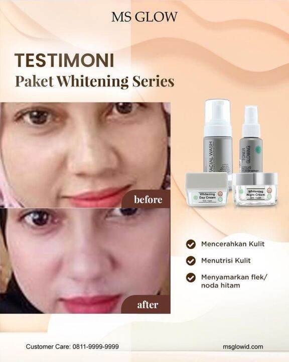 Day Cream MS GLOW Lazada Indonesia