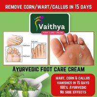 WART/CORN/ CALLUS OFF CREAM/NATURAL AYURVEDIC WART REMOVAL CREAM/ HERBAL FOOT CREAM/100 gms CORN REMOVAL CREAM/TRADITIONAL WART TREATMENT