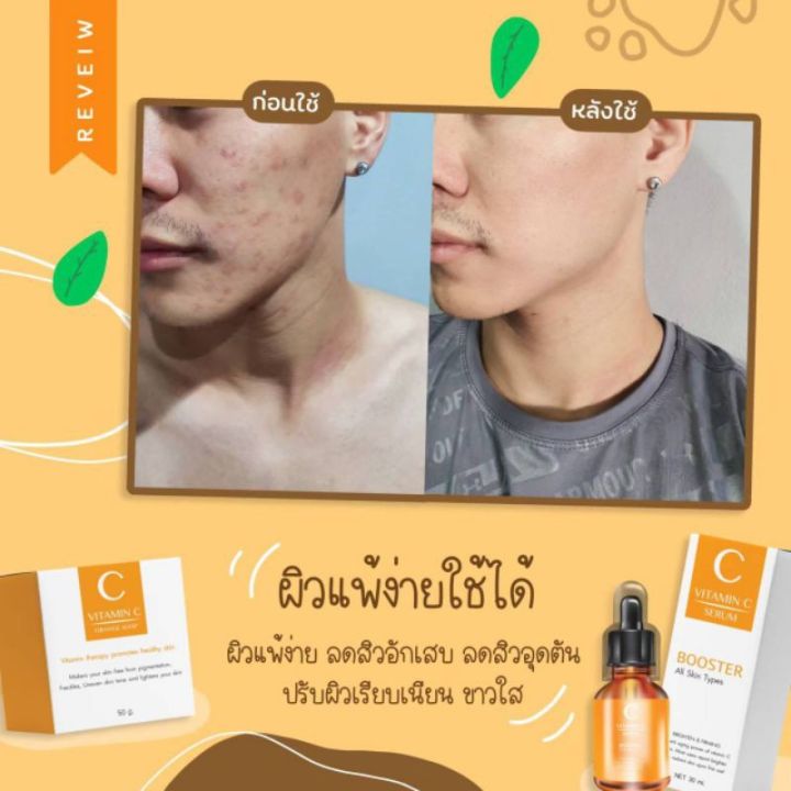 เซรั่มวิตซีส้ม-โปร1ขวด-แถมฟรีสบู่ส้ม1ก้อน-สินค้าพร้อมส่งของแท้เท่านั้น