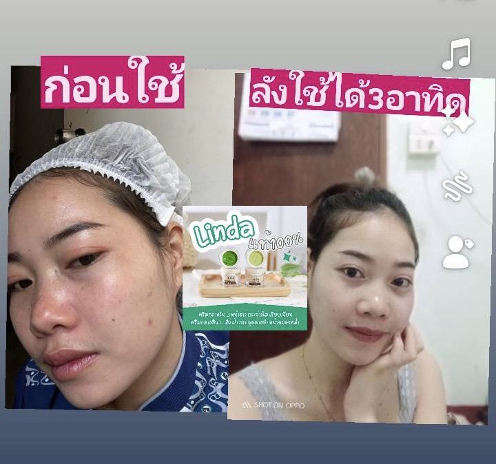 ครีมลินดาริช-สกินแคร์สูตรกลางวัน