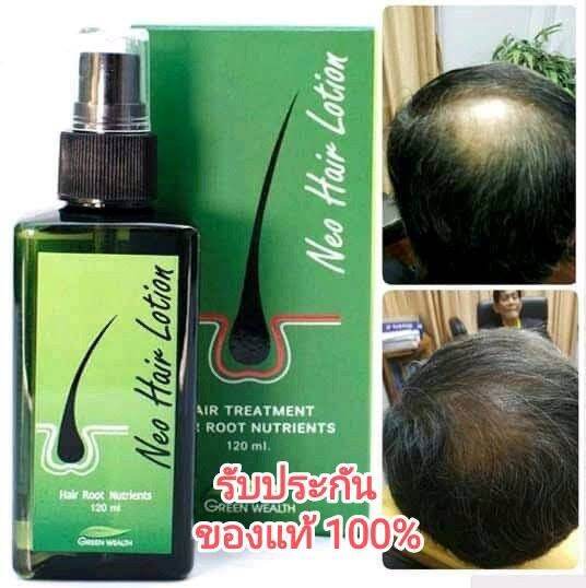 ของแท้-ส่งด่วนทุกวัน-neo-hair-lotion-เซรั่มปลูกผม-นีโอแฮร์โลชั่น-neohair-นีโอแฮร์