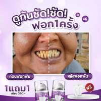 ติดชา ติดกาแฟ จนฟันเหลือง ฟอกครั้งเดียวคราบเหลืองลดลง Dental switz **ส่งฟรี** ยาสีฟันฟอกฟันขาว เจลฟอกสีฟัน แก้ฟันเหลือง ช่วยลดคราบฟันเหลืองจากการดื่มชา กาแฟ คราบบุหรี่ คราบหินปูน รวมไปถึงช่วยลดกลิ่นปาก และเหมาะสำหรับผู้ที่จัดฟันด้วยจ้า