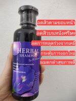 Herbal Shampoo(ช่วยลดสิวตามขอบหน้าและหนังศรีษะ)