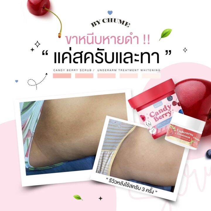 สครับผิวกลิ่นหอมเบอร์รี่-chume-candy-berry-scrub-ลดรอยดำคล้ำ-ผิวเนียน-ลดขนคุด-เนื้อนุ่มเนียนละเอียดไม่บาดผิว