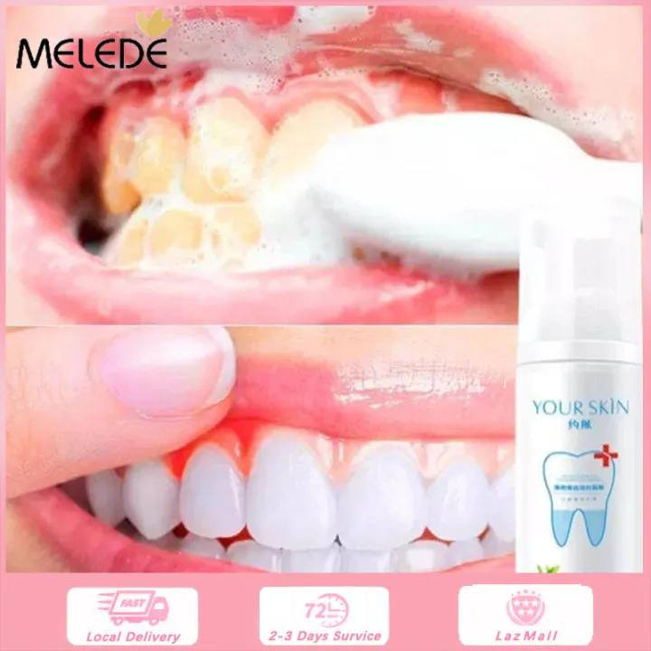 Teeth Whitening Serum Gel Dental Oral Hygiene Effective Remove Stains