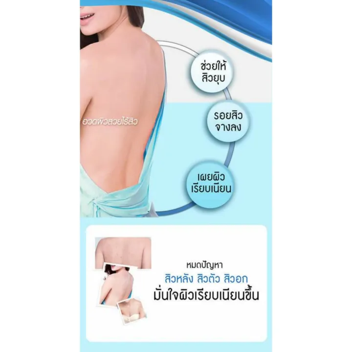 สเปรย์ฉีดสิว-มิสทีน-สิวบริเวณแผ่นหลัง-หน้าอก-หรือลำตัวหายเกลี้ยง-รอยสิวจางลง-แผ่นหลังเรียบเนียนขึ้น-ใส่ชุดไหนก็มั่นใจ