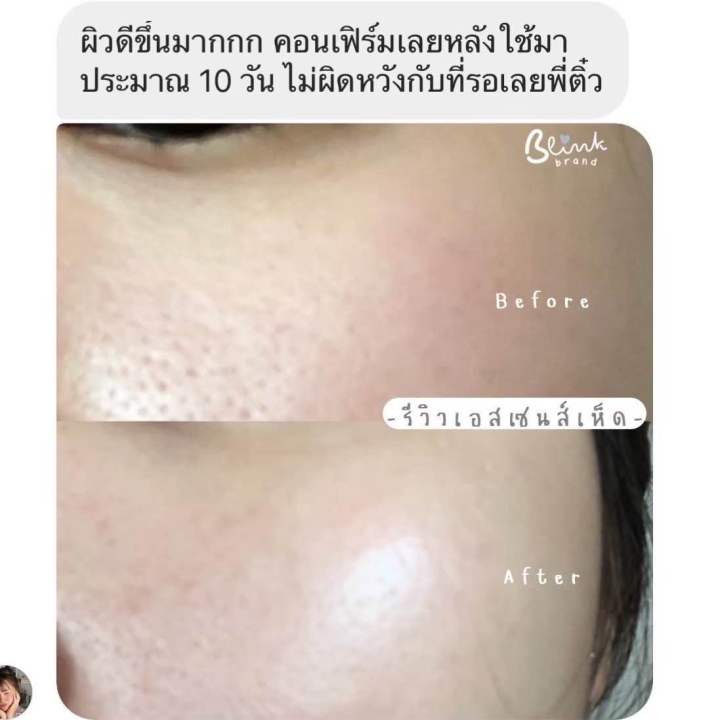 เอสเซนส์เห็ดใหญ่-30ml-เพิ่มมอยเจอร์ไรเซอร์-blahmbooh-แก้ปัญหารูขุมขนกว้างหน้าเนียน