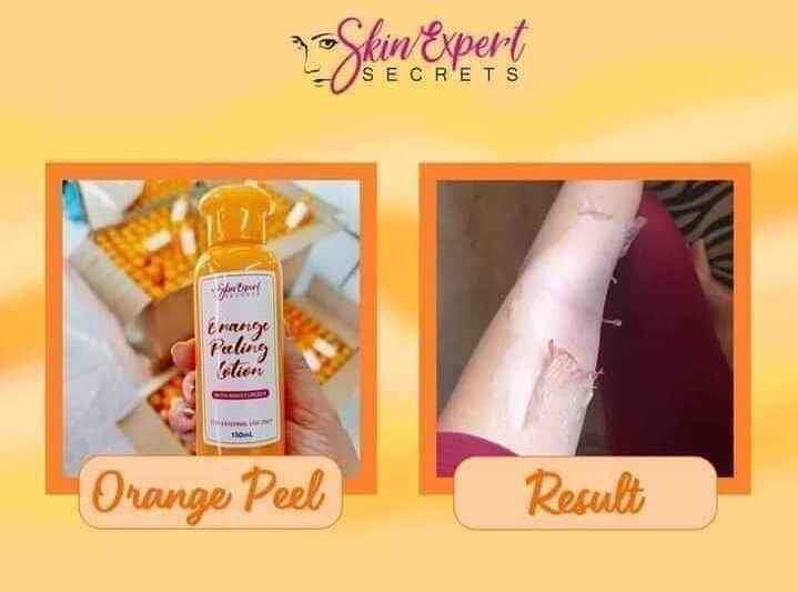 Orange Peeling Lotion by Skin Expert Lazada PH