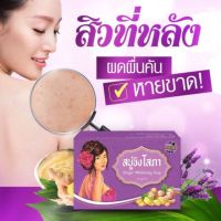 สบู่ขิงโสภาลดสิวหลังผดผื่นหายขาดใช้ดีมาก