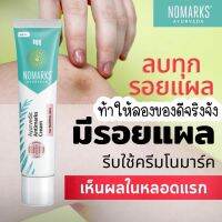 ใครที่มีปัญหาทางด้านสิว จุดด่างดำ 2025 เรทราคาส่ง ทักแชท ????????แนะนำให้ใช้ NoMarks ช่วยลดเลือนจุดด่างดำได้ดีมากๆมีราคาส่งจร้าาา ต้านแบคทีเรียที่ก่อให้เกิดสิว