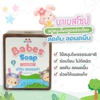 Babes Soap บาเบส โซฟ สบู่แก้คัน ขาลาย แพ้ยุง