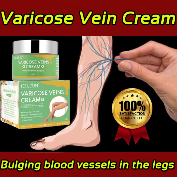 SEFUDUN Original Varicose Vein Treatment Cream Spider Vein Pain ...